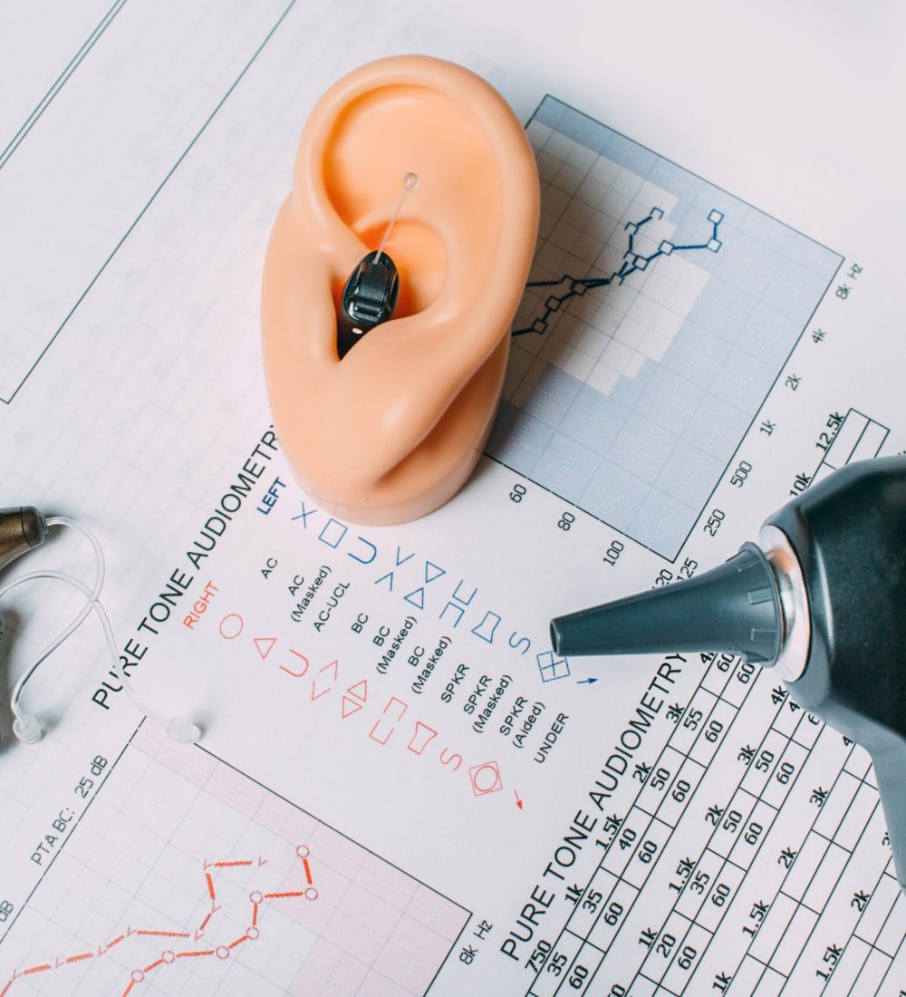 Hearing test concept. Result of hearing exam - audiogram, hearing aids and otoscope on the table, view from above.